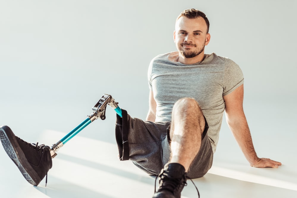 Houston man with an amputated leg injury